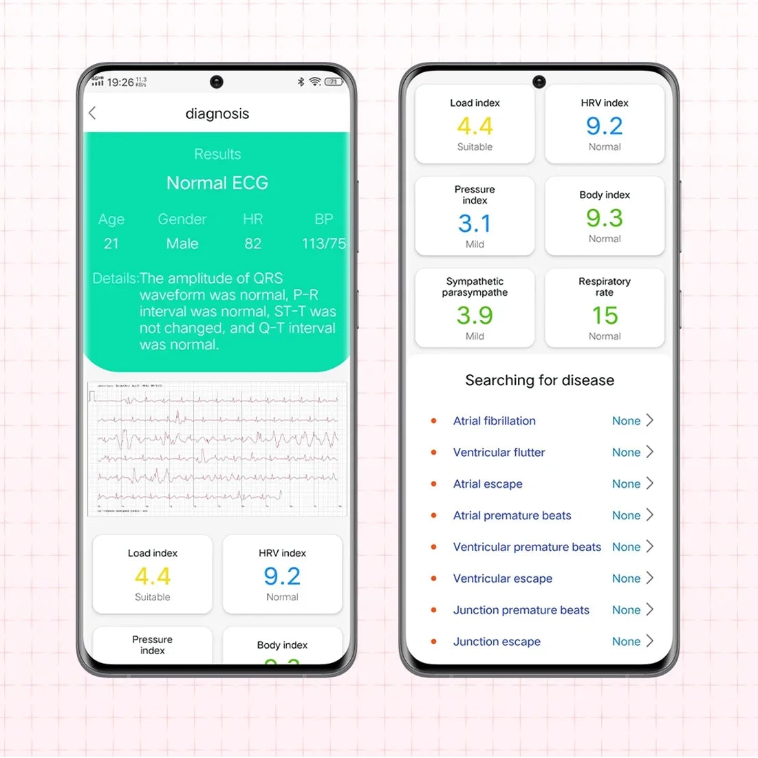 btorly™ Smart Air Health Watch